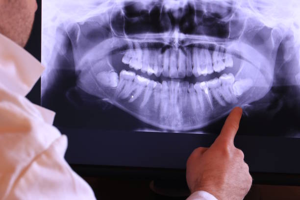 Best Emergency Root Canal Treatment in Antlers, OK